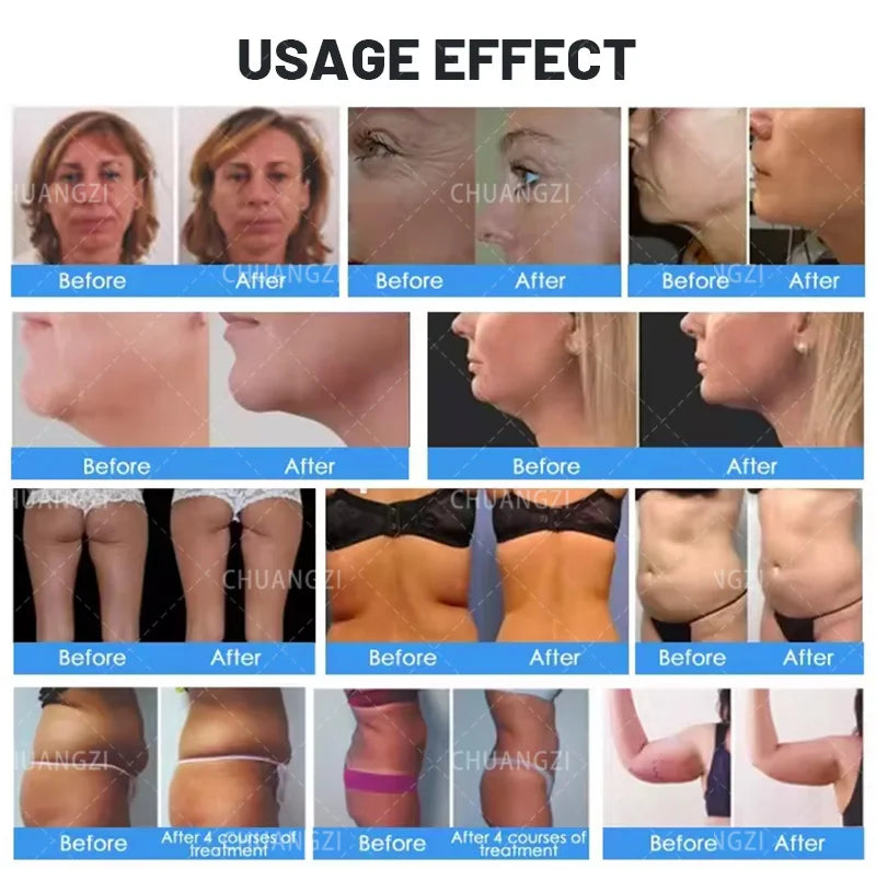 2 in 1 RF ULTRA 360 Body Contouring Cellulite Reduction Face Skin Rejuvenation Tightening Beauty Machine 2025