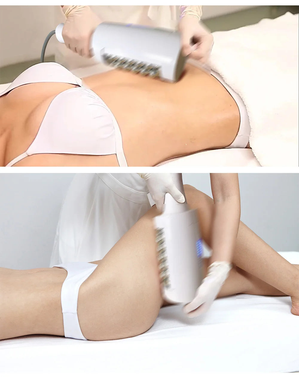 MYOSLIM 6500W 200HZ Roller Slimming Cellulite Reduction Inner Ball Roller 360 Degree Infrared Vacuum Roller Massage Beauty