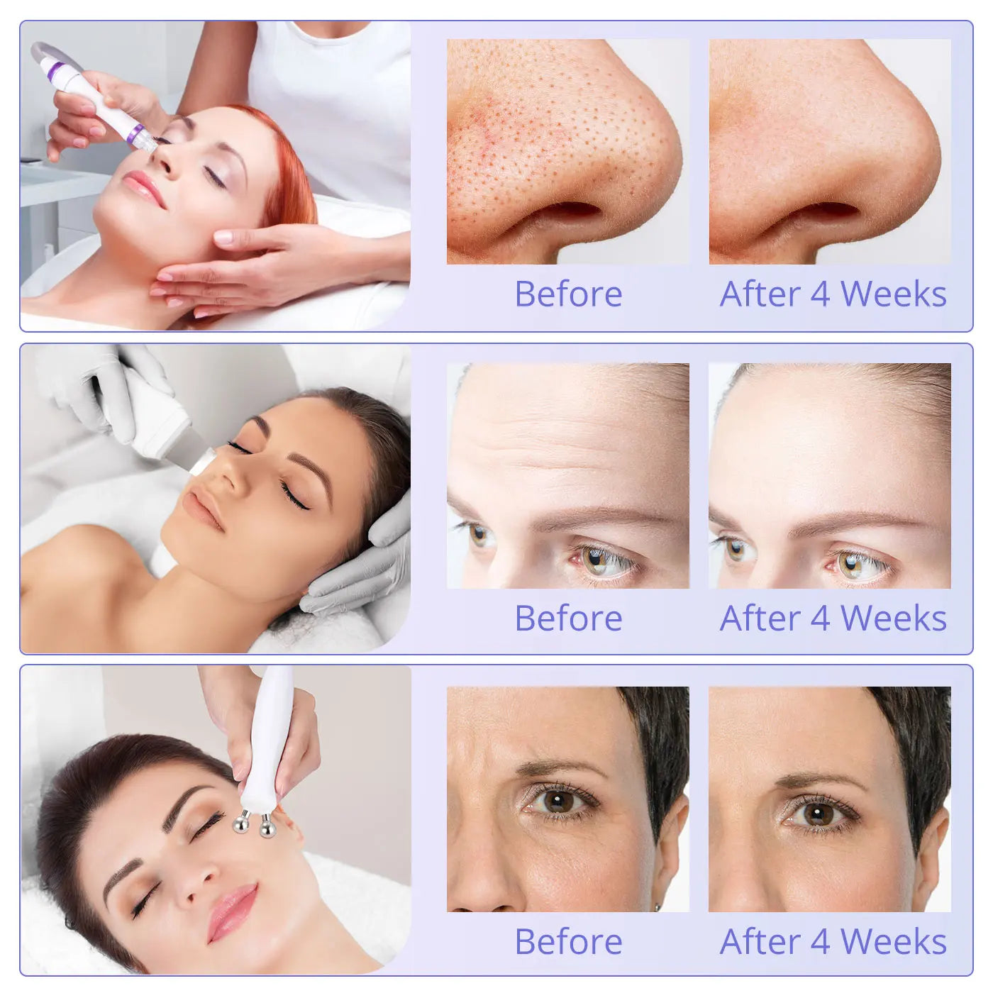 6in 1 H2O2 Small Bubble Facial Therapy Facial Cleaning Beauty Machine