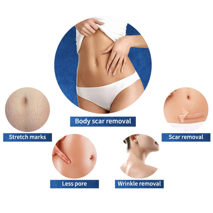 Beauty Products for Women Microneedling Radiofrequenz Professional Microneedle Non Needle Fractional Rf Machine Micro Needles d